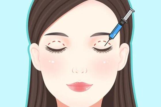 双眼皮手术后忌口多久？常规1 - 2周，特殊体质及恢复慢者时间大不同！ 