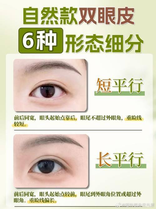 韩国双眼皮修复多少钱？各医院价格差异分析