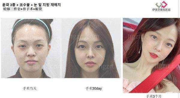 韩国伊美芝皮肤科口碑怎么样？技术实力见真章