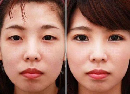 特殊體質的忌口時間