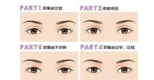 不同醫生的建議