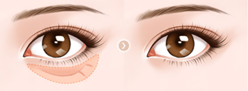 價格大對比：性價比的考量