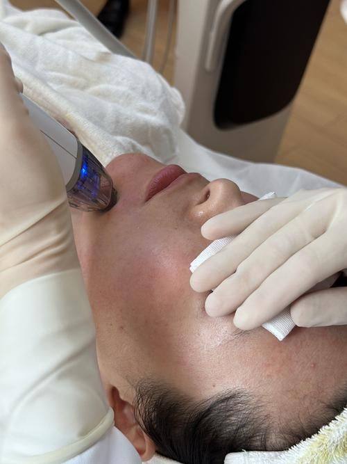 功效區別：祛斑美白VS緊致抗衰