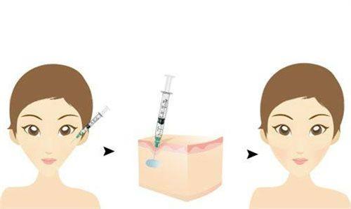 如何選擇含透明質酸的產品