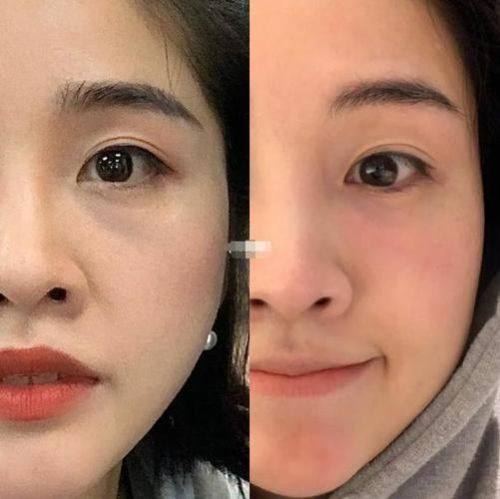 功效差異看安心性