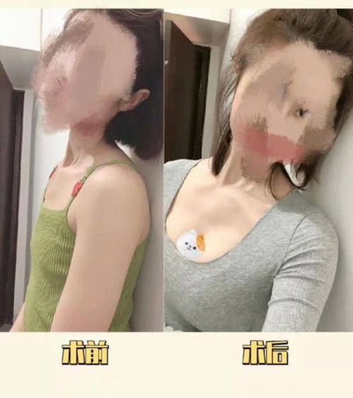 韩国THE整形外科——实力强劲的佼佼者