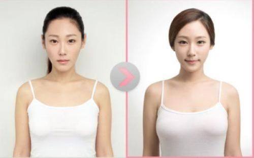 韩国MD整形外科——专注品质的优质之选