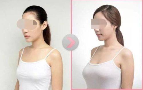 韩国棒棒整形医院——独具特色的魅力之选