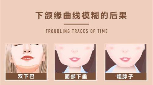 有輕度皺紋的人群