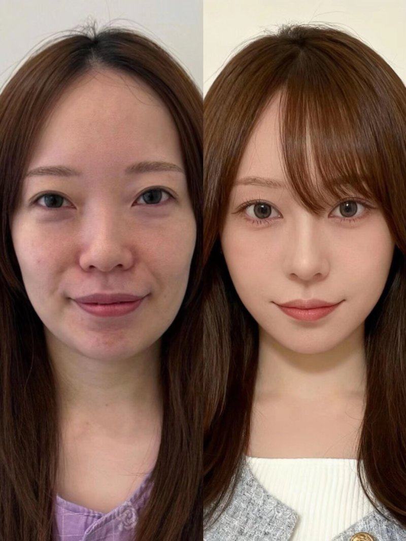 皮膚缺乏彈性的人群