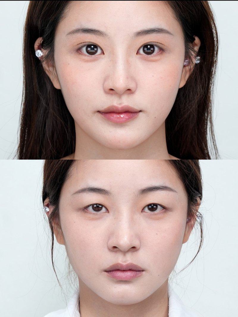 綜合抗衰方案:一站式年輕化解決方案