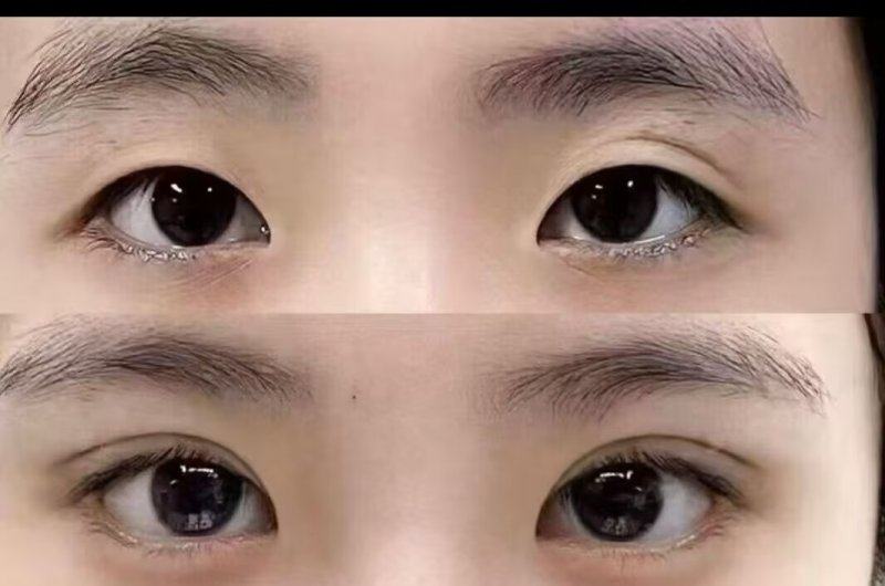 服務貼心之選:Only Eye、GNG