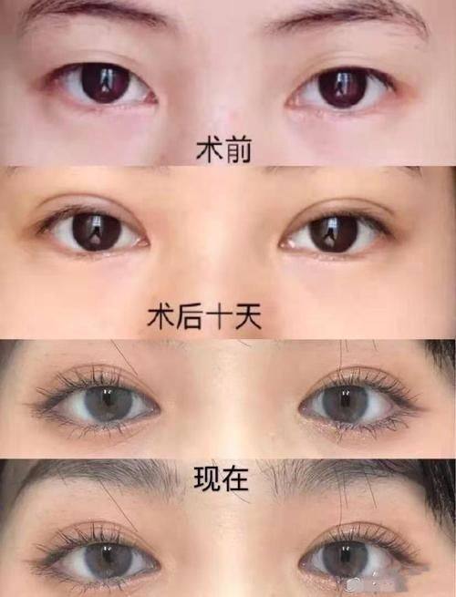 其他特色醫院:id、珠兒麗、EH愛護、TS、Dream Face