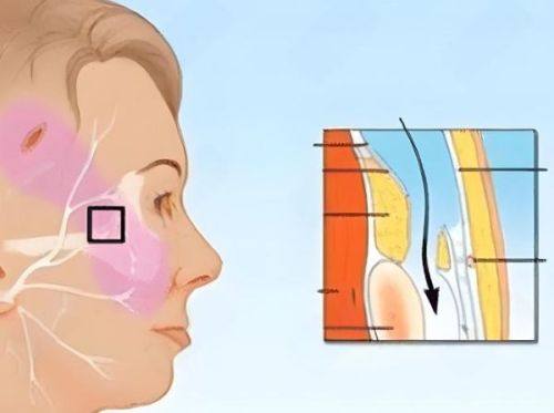 術後保養與注意事項