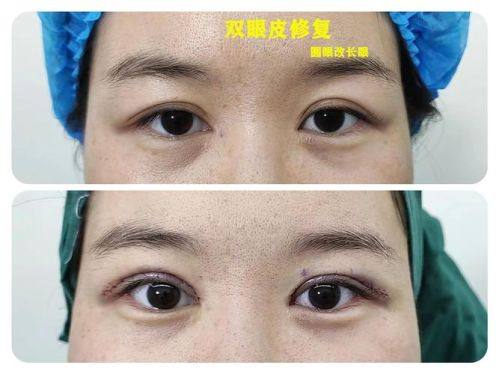 價格與便利性:變美路上的現實考量