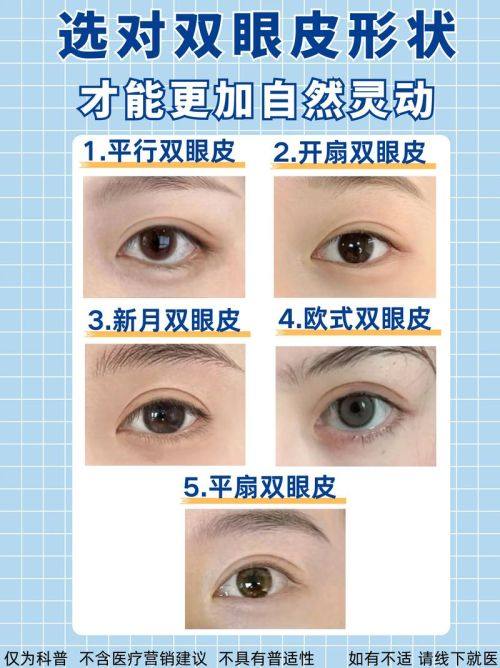 適用人羣差異:找到更適合自己的手術