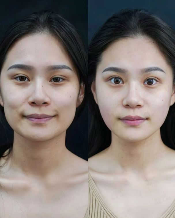 韩国mycell皮肤科怎么约？多种预约方式揭秘，享济州岛&ldquo;变美+度假&rdquo;体验！ 