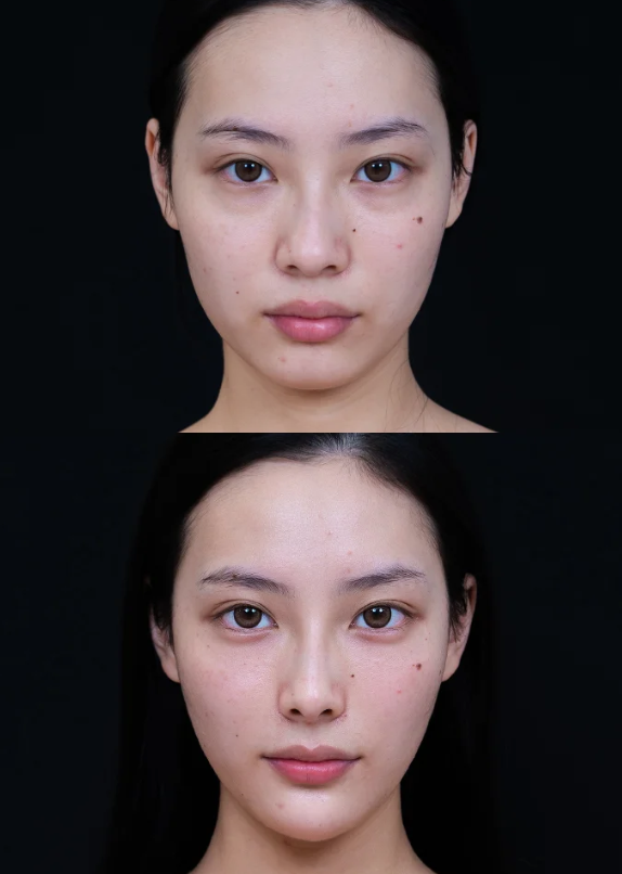 韓國mycell皮膚科怎麼約?先了解它的魅力