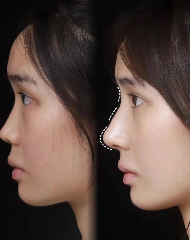 韓國mycell皮膚科怎麼約?多種方式任你選