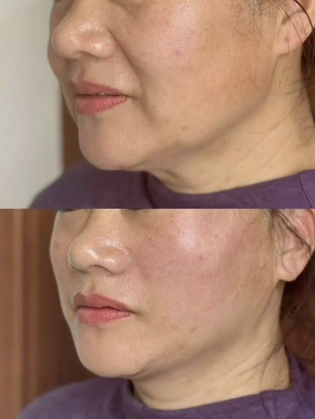 韓國mycell皮膚科怎麼約?預約流程大揭秘