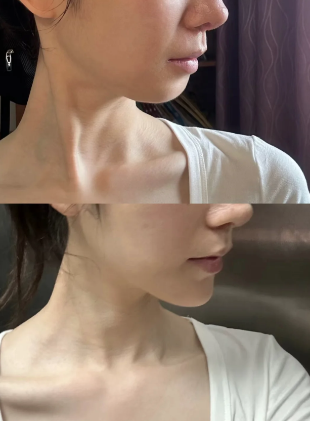 韓國mycell皮膚科怎麼約?預約小貼士要記牢