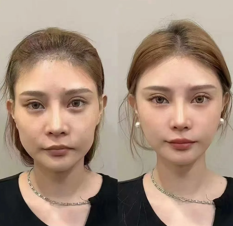 韓國mycell皮膚科怎麼約?和其他皮膚科的對比