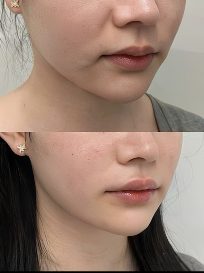 選擇皮膚科的注意事項