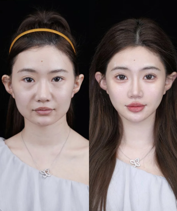 美白祛斑類項目：煥發白皙光彩