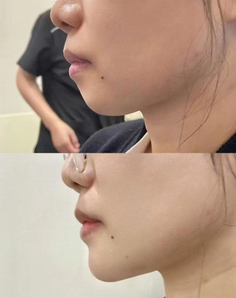 補水保濕類項目：滋潤乾渴肌膚