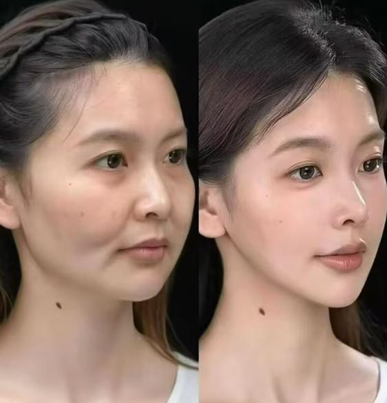 其他類項目：多樣選擇滿足不同需求