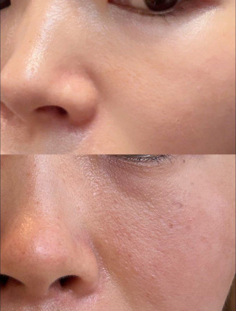 術後注意事項：護理不當前功盡棄