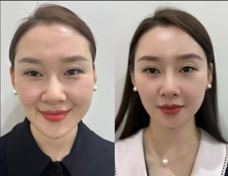 熱門項目組合套餐：成效加倍