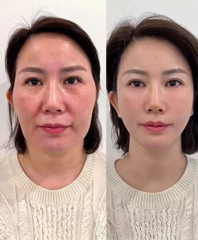 疼痛敏感且面部有需求人群