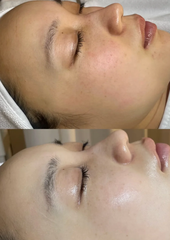 希里芙皮肤科皮肤营养套餐，你了解多少？