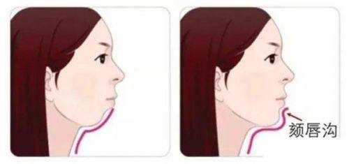 希里芙皮肤科针剂塑形套餐的优势