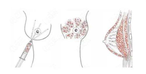 套餐里都有啥项目