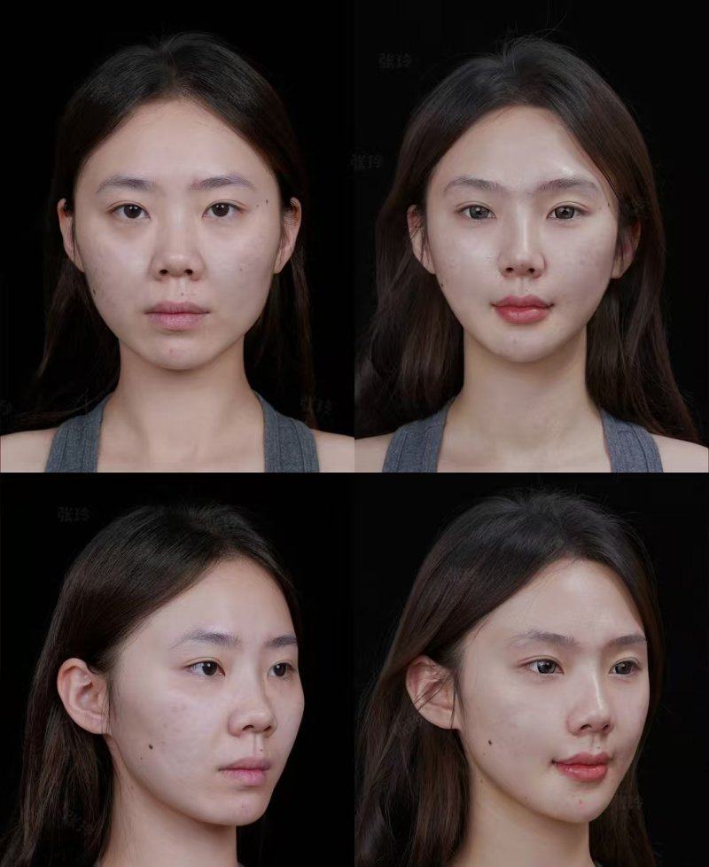 治疗过程体验感