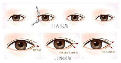 玻尿酸圣手的实力体现