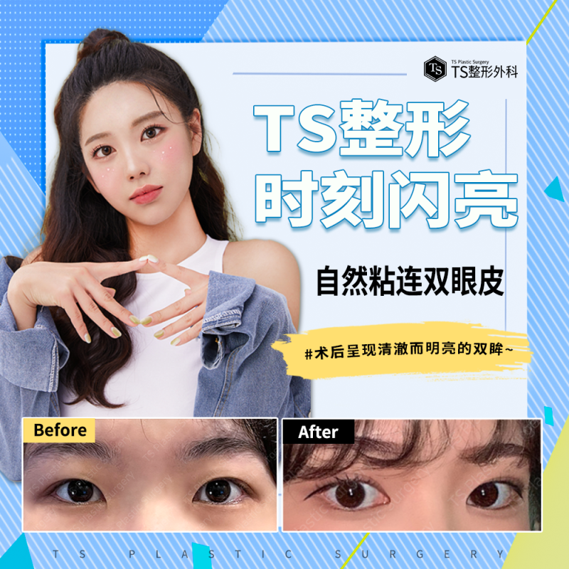 顾客在希里芙皮肤科的真实体验