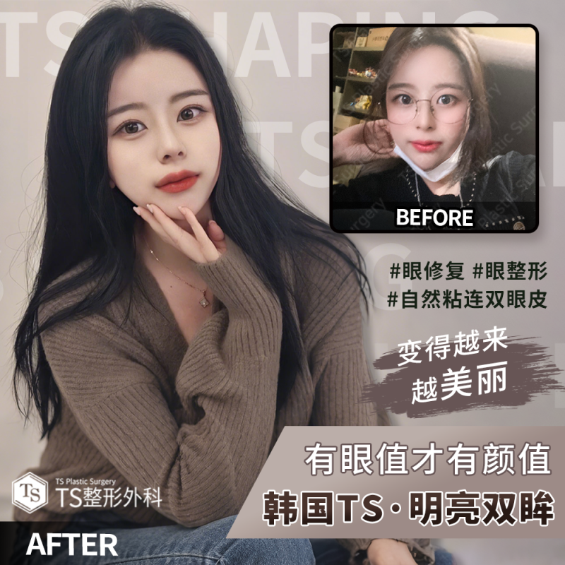 XERF高频射频提升设备的原理与技术